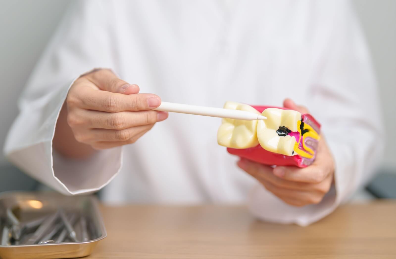 Close-up of a tooth model used to explain decay.