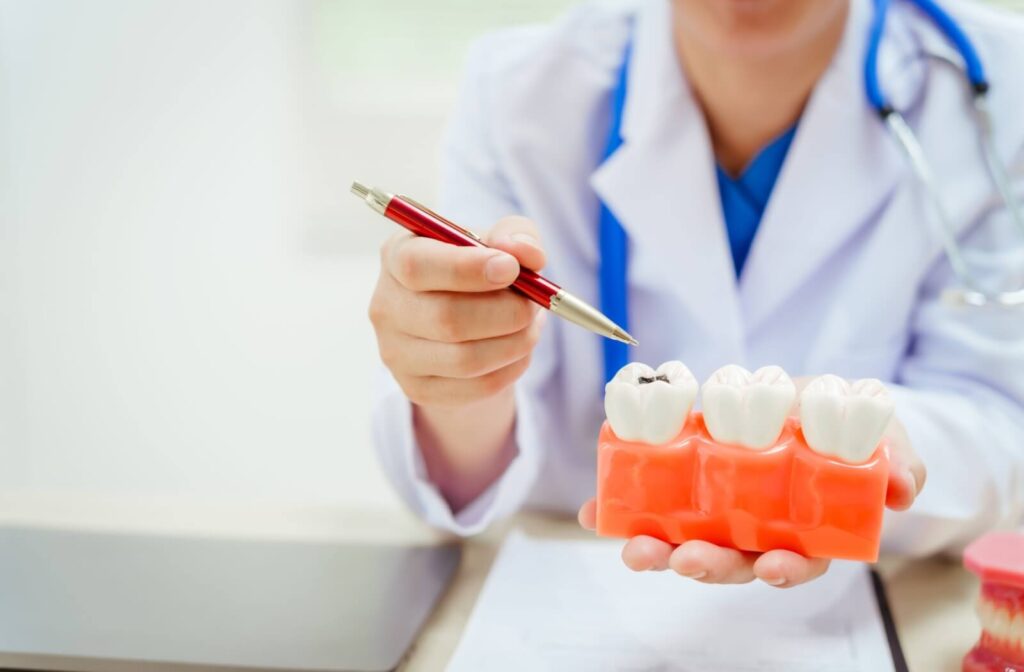 A dental professional using a pen to point to a cavity on a large-scale dental model during a patient consultation.