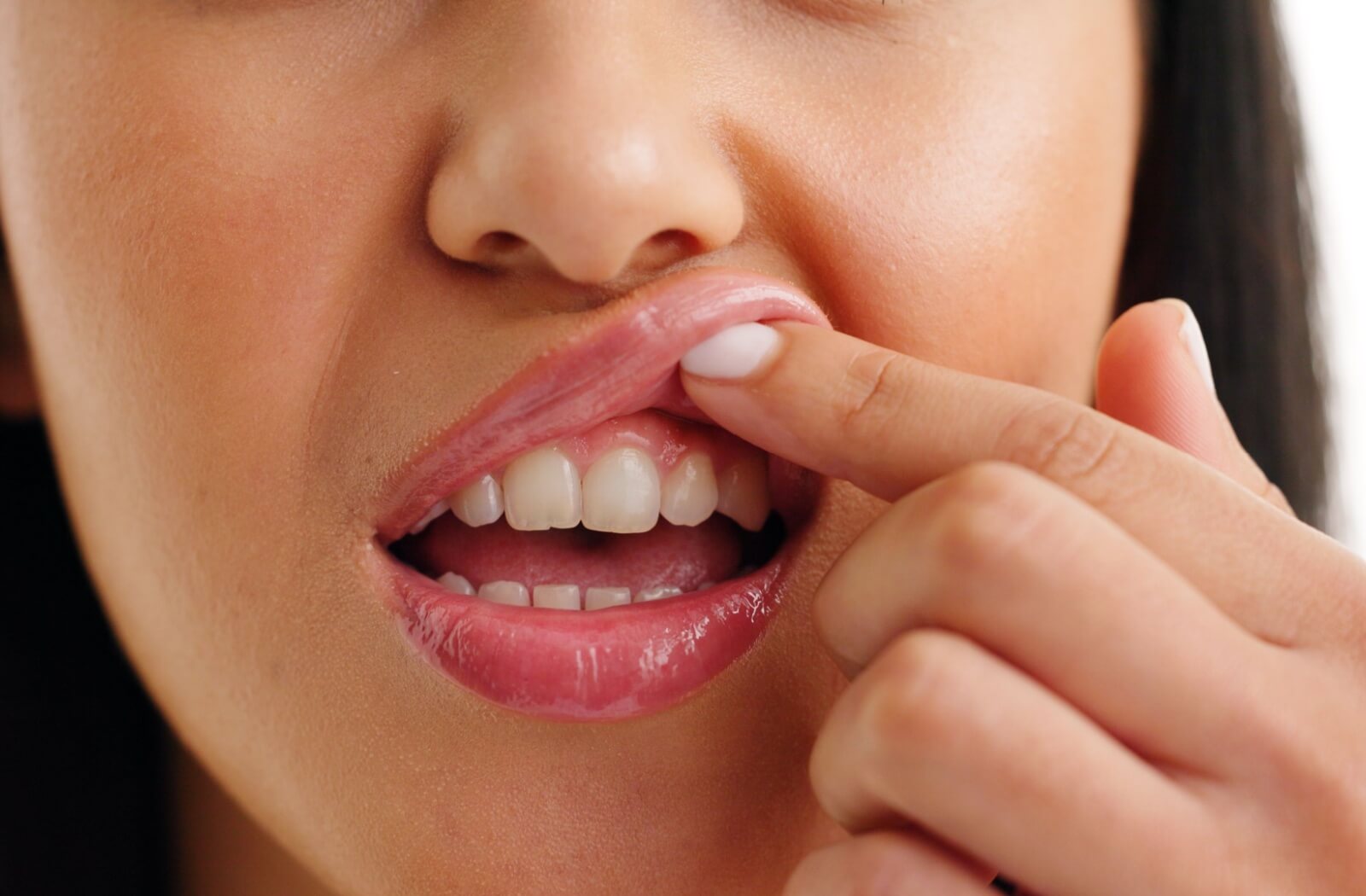 A close-up of an individual lifting their upper lip with a finger to examine their teeth and gum line.