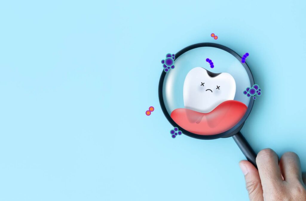 An illustration of a magnifying glass held over a sad cartoon tooth surrounded by colorful bacteria icons on a light blue background.